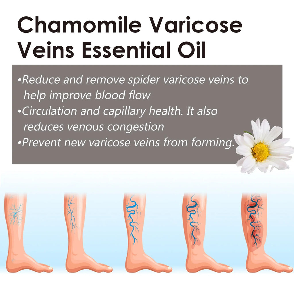 10ml chamomile essential oil bottle for leg massage and discomfort relief
