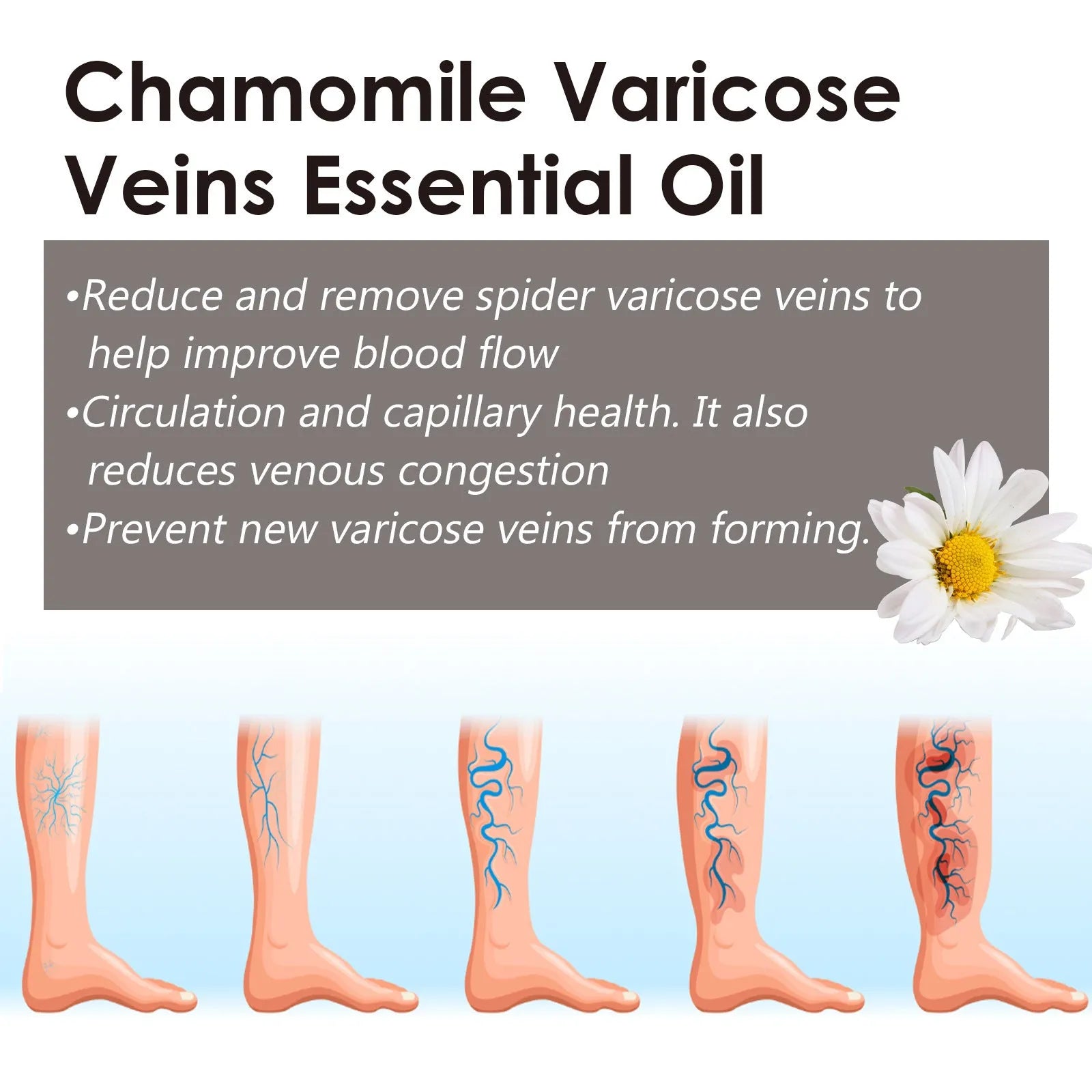 10ml chamomile essential oil bottle for leg massage and discomfort relief