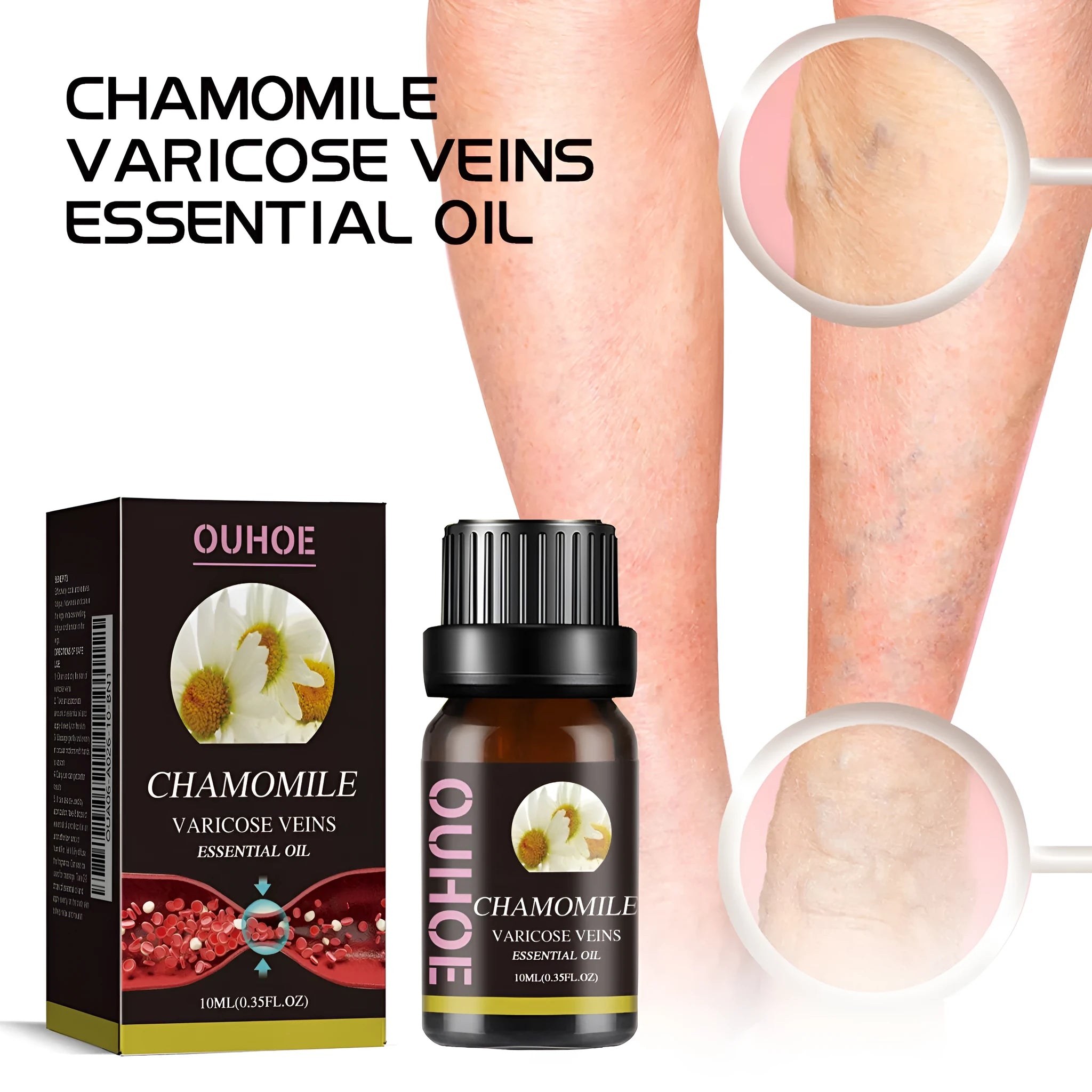 10ml chamomile essential oil bottle for leg massage and discomfort relief