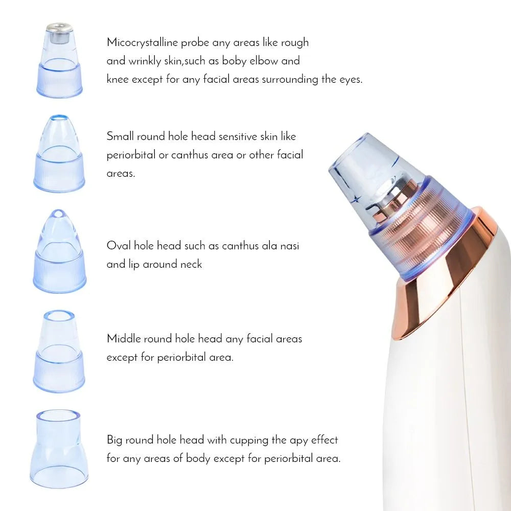Electric blackhead remover device with four nozzle attachments in different colours