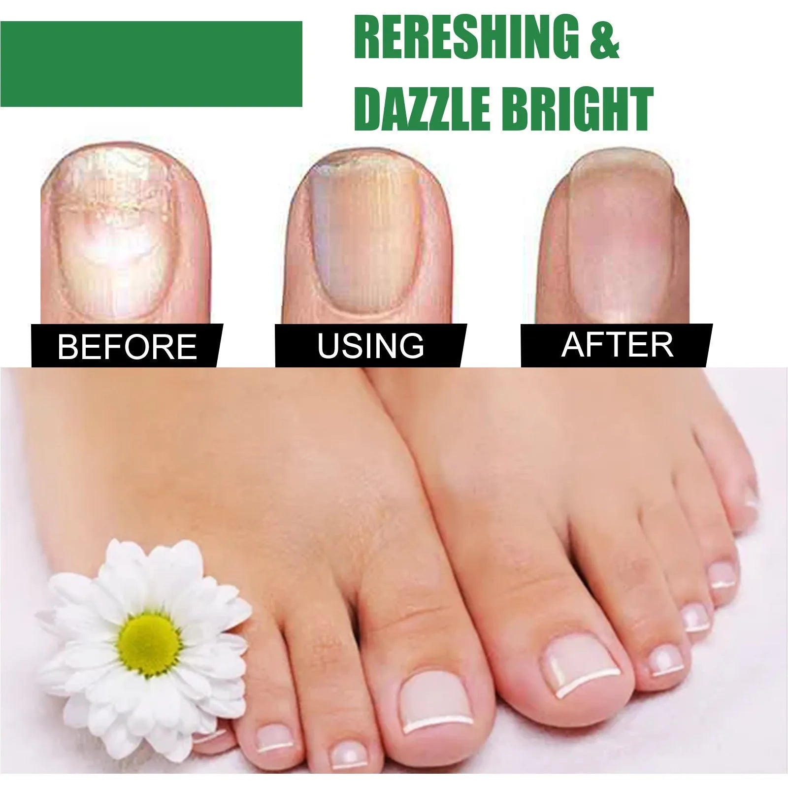 30ml tea tree oil nail care repair fluid bottle for thick soft hand foot nails