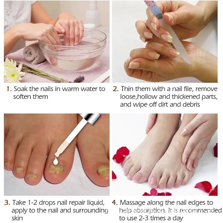 10ml bottle of Deck Antimicrobial Whitenail Liquid for toenail treatment.