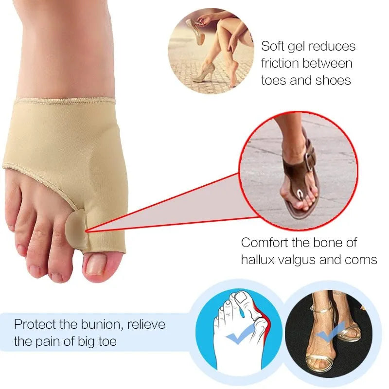 Pair of beige corrective toe socks with a clear silicone gel bunion pad and toe separator.