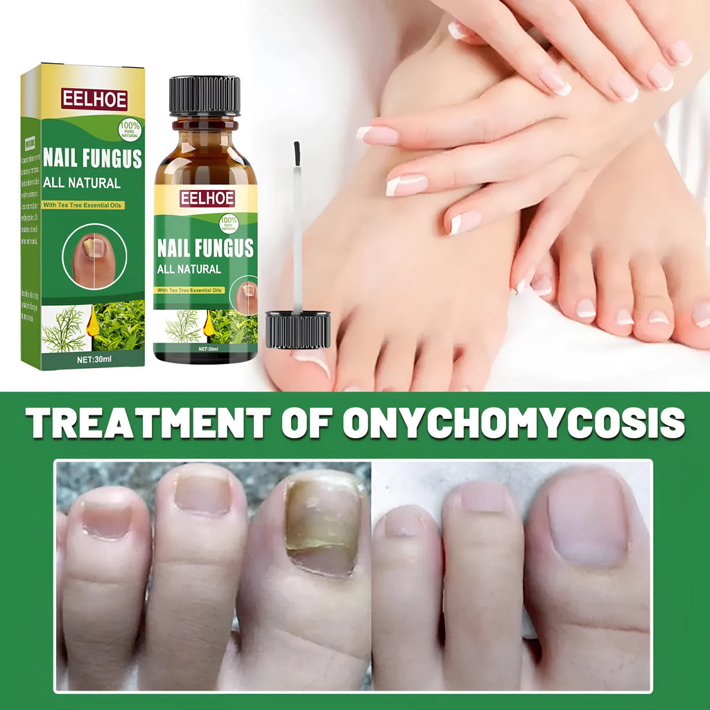 30ml tea tree oil nail care repair fluid bottle for thick soft hand foot nails