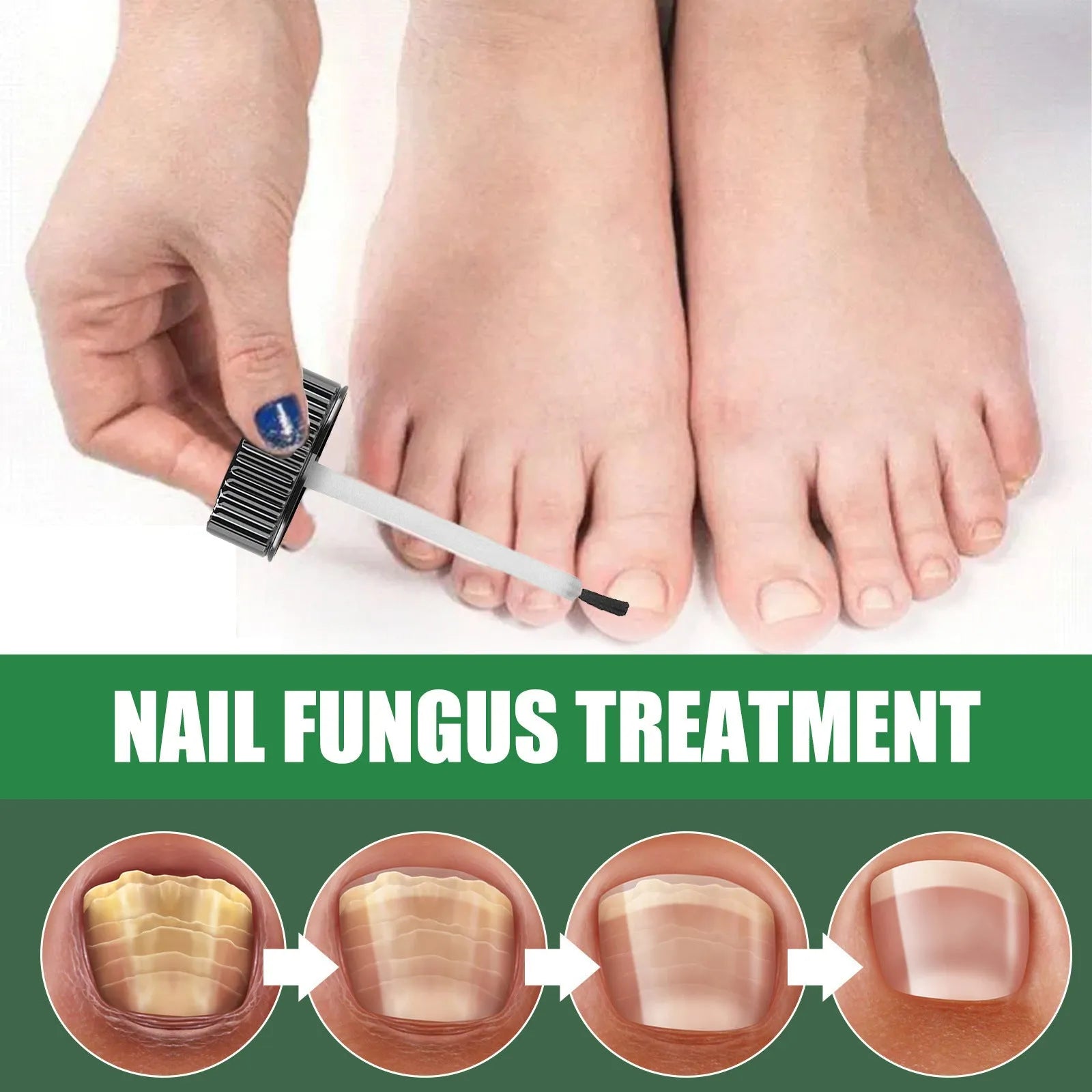 30ml tea tree oil nail care repair fluid bottle for thick soft hand foot nails