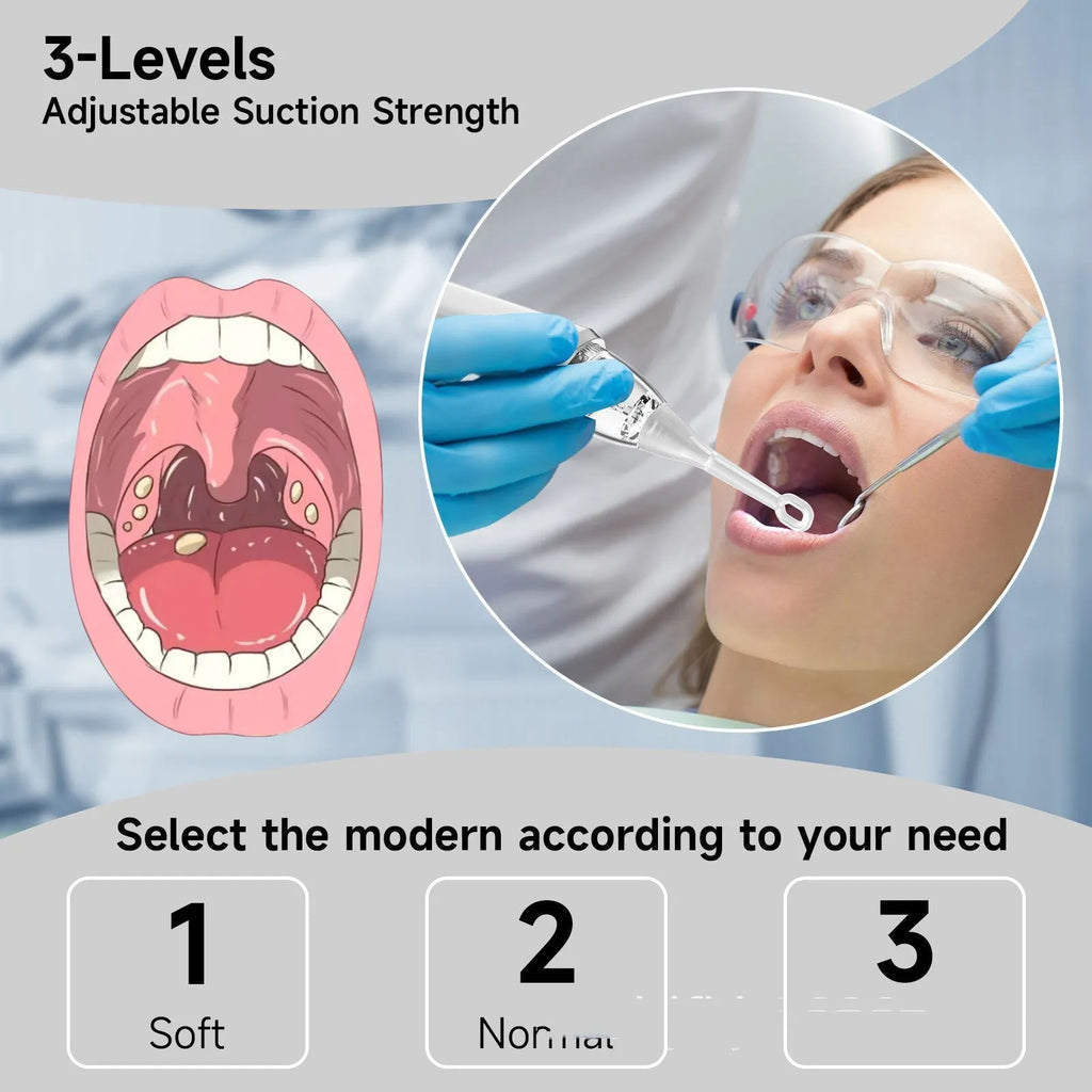 Milky white tonsil stone remover oral cleaning tool with built-in light on a white background.