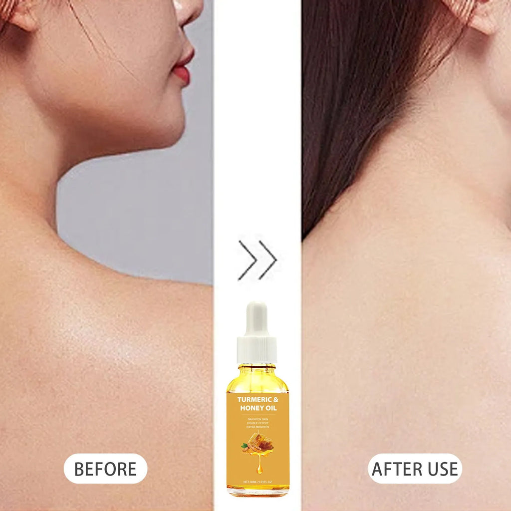 30ml bottle of turmeric honey essential oil with neutral packaging for facial beauty applications